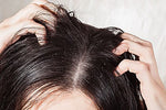 Does Dry Scalp Cause Hair Fall?