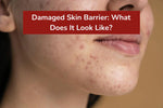 How to tell if your skin barrier is damaged.