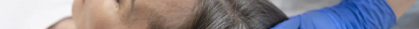 What is the best treatment for hair loss?