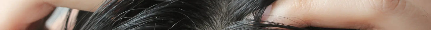 how to get rid of dandruff