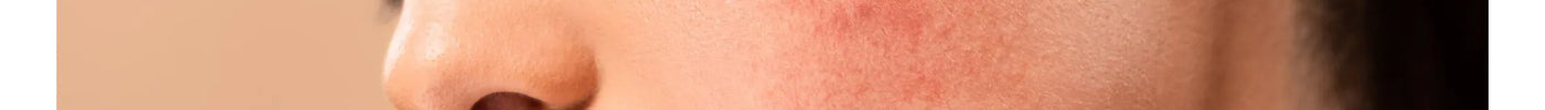How to remove dark spots from face !!