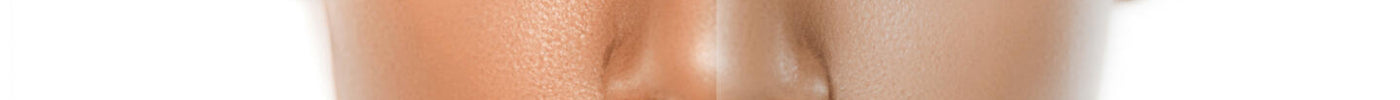 The Causes and Treatments for Dull Looking Skin